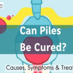পাইলস কি ভালো হয়