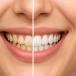 দাঁত ওয়াশ করার আগে ও পরে - DoctorBD24.com